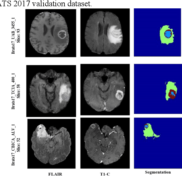 Figure 3 for MRI Brain Tumor Segmentation using Random Forests and Fully Convolutional Networks