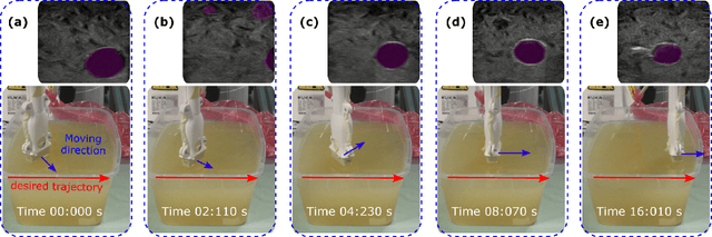 Figure 2 for Autonomous Robotic Screening of Tubular Structures based only on Real-Time Ultrasound Imaging Feedback