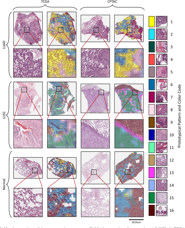 Figure 4 for Handcrafted Histological Transformer (H2T): Unsupervised Representation of Whole Slide Images