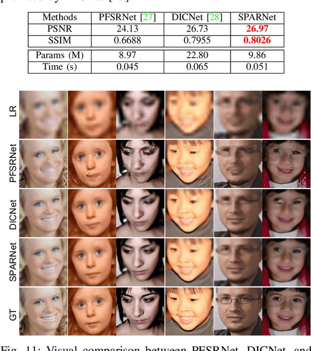 Figure 3 for Learning Spatial Attention for Face Super-Resolution