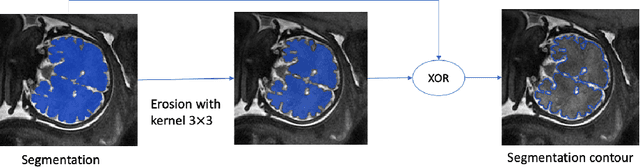 Figure 1 for Contour Dice loss for structures with Fuzzy and Complex Boundaries in Fetal MRI