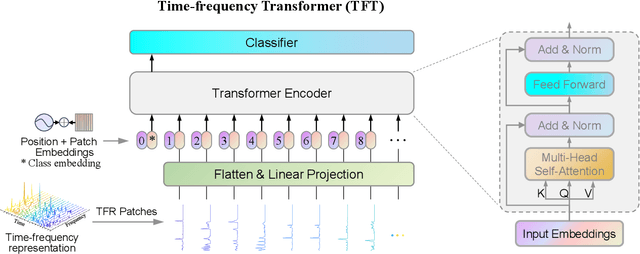 Figure 3 for A novel Time-frequency Transformer and its Application in Fault Diagnosis of Rolling Bearings