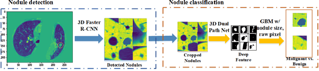Figure 1 for DeepLung: 3D Deep Convolutional Nets for Automated Pulmonary Nodule Detection and Classification