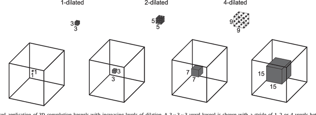 Figure 3 for Coronary Artery Centerline Extraction in Cardiac CT Angiography Using a CNN-Based Orientation Classifier