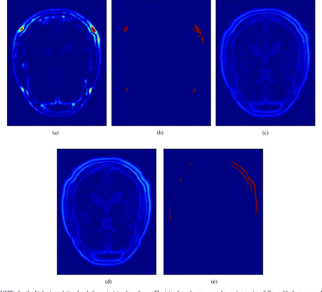 Figure 2 for Uncertainty driven probabilistic voxel selection for image registration