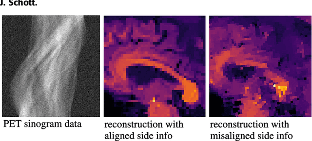 Figure 2 for Robust Image Reconstruction with Misaligned Structural Information