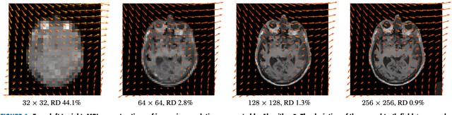Figure 4 for Robust Image Reconstruction with Misaligned Structural Information