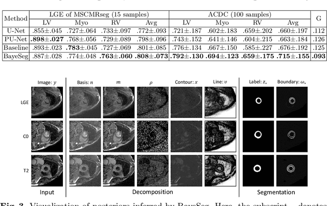 Figure 3 for Joint Modeling of Image and Label Statistics for Enhancing Model Generalizability of Medical Image Segmentation