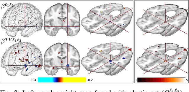 Figure 2 for Continuation of Nesterov's Smoothing for Regression with Structured Sparsity in High-Dimensional Neuroimaging