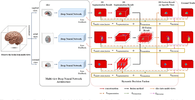 Figure 3 for A Multi-View Dynamic Fusion Framework: How to Improve the Multimodal Brain Tumor Segmentation from Multi-Views?