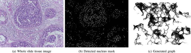 Figure 2 for Visualization for Histopathology Images using Graph Convolutional Neural Networks