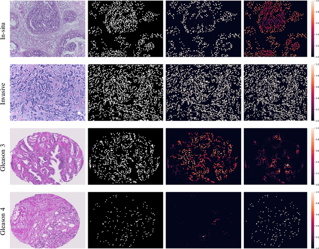 Figure 3 for Visualization for Histopathology Images using Graph Convolutional Neural Networks