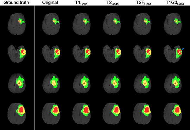 Figure 2 for Which Contrast Does Matter? Towards a Deep Understanding of MR Contrast using Collaborative GAN