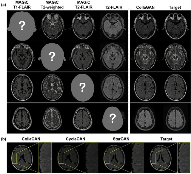 Figure 4 for Which Contrast Does Matter? Towards a Deep Understanding of MR Contrast using Collaborative GAN