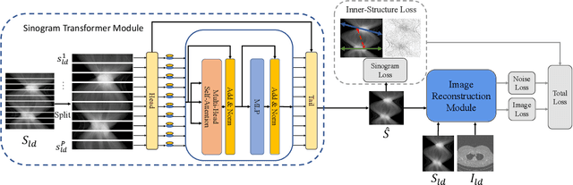 Figure 3 for Low-Dose CT Denoising via Sinogram Inner-Structure Transformer