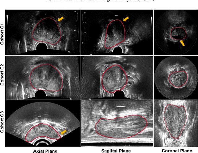 Figure 1 for Domain Generalization for Prostate Segmentation in Transrectal Ultrasound Images: A Multi-center Study