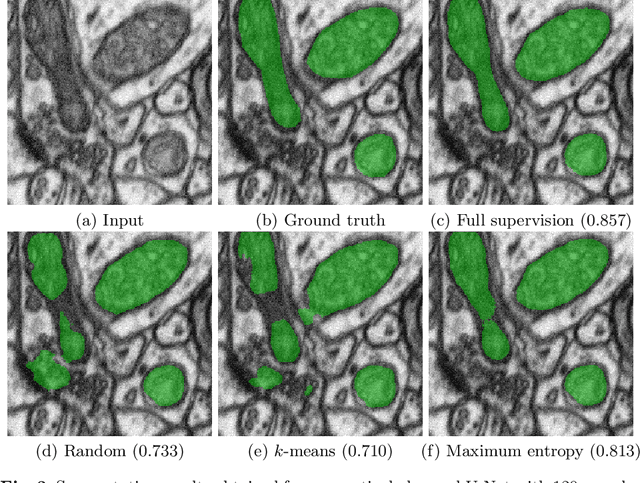 Figure 3 for Cost-efficient segmentation of electron microscopy images using active learning