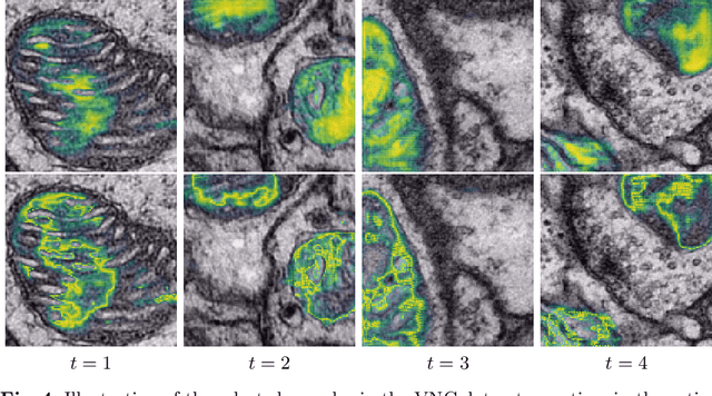 Figure 4 for Cost-efficient segmentation of electron microscopy images using active learning