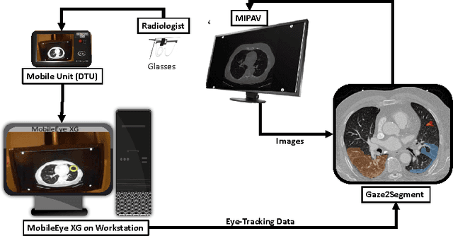 Figure 1 for Gaze2Segment: A Pilot Study for Integrating Eye-Tracking Technology into Medical Image Segmentation
