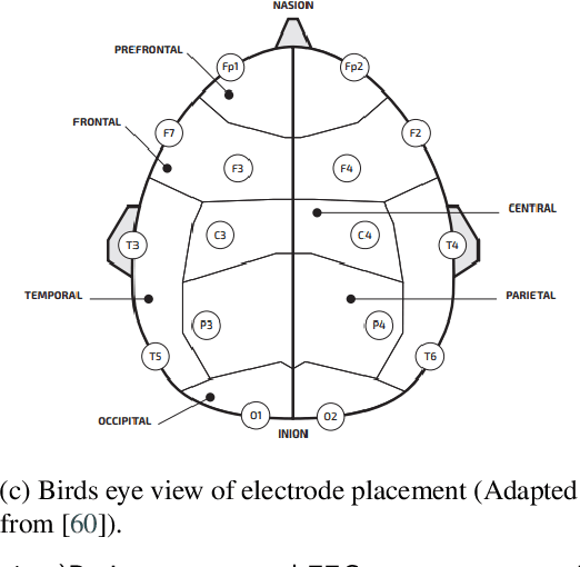 Figure 2 for Neural Networks based approaches for Major Depressive Disorder and Bipolar Disorder Diagnosis using EEG signals: A review