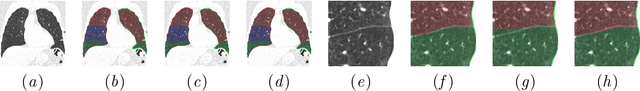 Figure 3 for Automatic segmentation of the pulmonary lobes with a 3D u-net and optimized loss function
