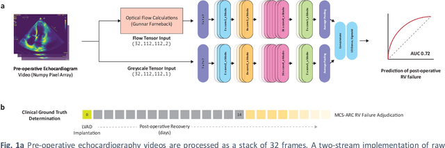 Figure 1 for Predicting post-operative right ventricular failure using video-based deep learning