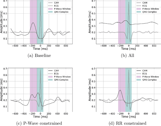 Figure 4 for Using Deep Networks for Scientific Discovery in Physiological Signals