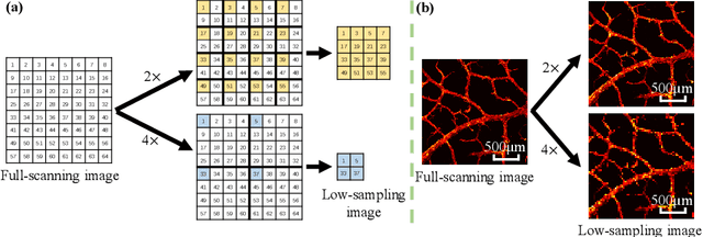 Figure 1 for Photoacoustic Microscopy with Sparse Data Enabled by Convolutional Neural Networks for Fast Imaging