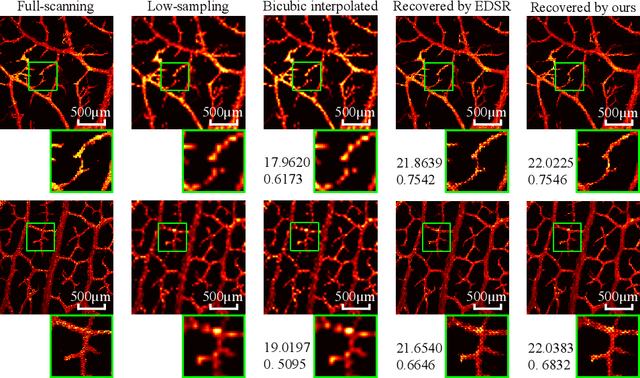Figure 4 for Photoacoustic Microscopy with Sparse Data Enabled by Convolutional Neural Networks for Fast Imaging