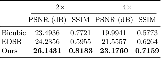 Figure 2 for Photoacoustic Microscopy with Sparse Data Enabled by Convolutional Neural Networks for Fast Imaging