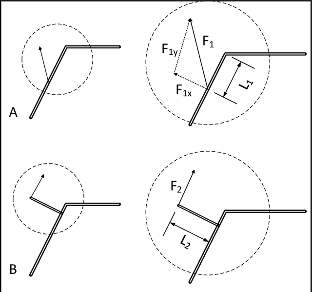 Figure 1 for Mechanical Orthosis Mechanism to Facilitate the Extension of the Leg