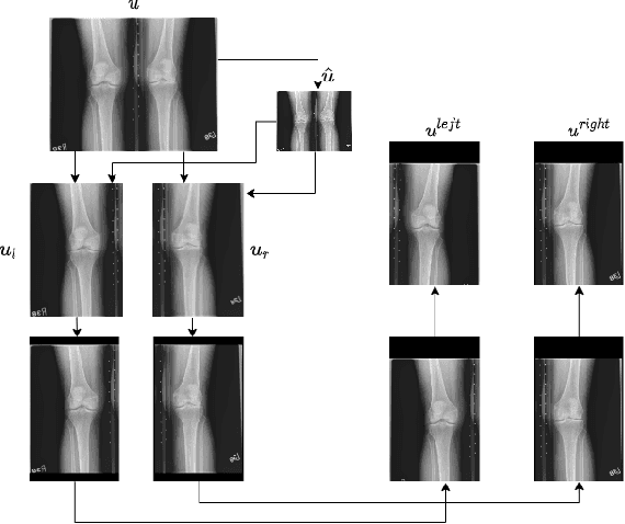 Figure 1 for A Neural Template Matching Method to Detect Knee Joint Areas