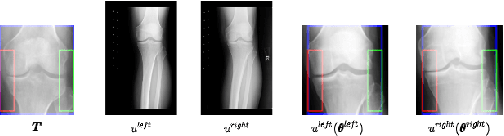 Figure 3 for A Neural Template Matching Method to Detect Knee Joint Areas