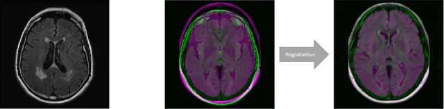 Figure 1 for FlowReg: Fast Deformable Unsupervised Medical Image Registration using Optical Flow