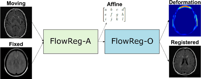 Figure 3 for FlowReg: Fast Deformable Unsupervised Medical Image Registration using Optical Flow