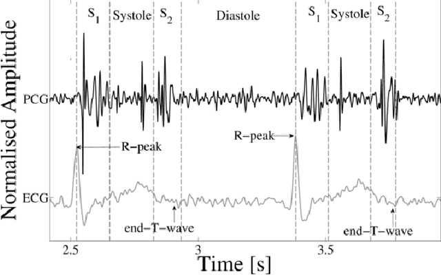 Figure 1 for Recognizing Abnormal Heart Sounds Using Deep Learning