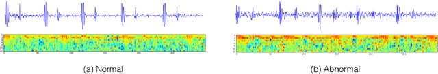 Figure 3 for Recognizing Abnormal Heart Sounds Using Deep Learning