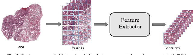 Figure 2 for EGFR Mutation Prediction of Lung Biopsy Images using Deep Learning