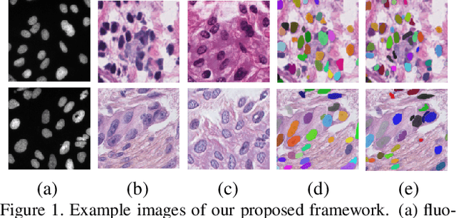 Figure 1 for Unsupervised Instance Segmentation in Microscopy Images via Panoptic Domain Adaptation and Task Re-weighting