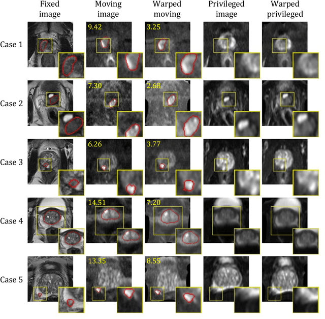 Figure 3 for Cross-Modality Image Registration using a Training-Time Privileged Third Modality