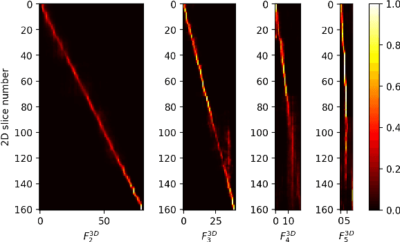 Figure 4 for Spatial Context-Aware Self-Attention Model For Multi-Organ Segmentation