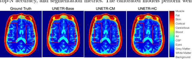 Figure 3 for DOMINO: Domain-aware Model Calibration in Medical Image Segmentation