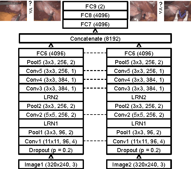 Figure 3 for Unsupervised temporal context learning using convolutional neural networks for laparoscopic workflow analysis