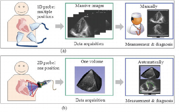 Figure 3 for Shape Detection In 2D Ultrasound Images