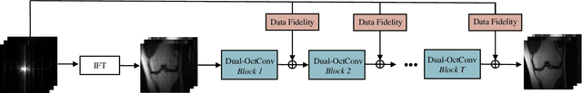 Figure 3 for DONet: Dual-Octave Network for Fast MR Image Reconstruction