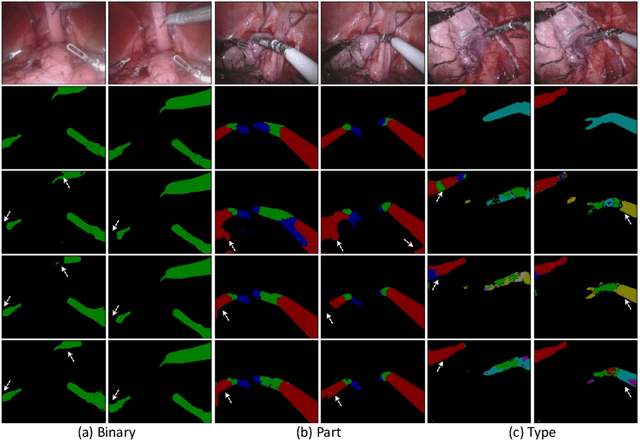 Figure 3 for Incorporating Temporal Prior from Motion Flow for Instrument Segmentation in Minimally Invasive Surgery Video