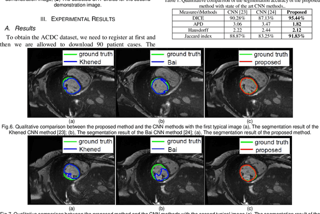 Figure 1 for Fully Automated Segmentation of the Left Ventricle in Magnetic Resonance Images