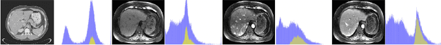 Figure 1 for Unsupervised Domain Adaptation via Disentangled Representations: Application to Cross-Modality Liver Segmentation