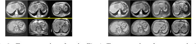 Figure 3 for Unsupervised Domain Adaptation via Disentangled Representations: Application to Cross-Modality Liver Segmentation