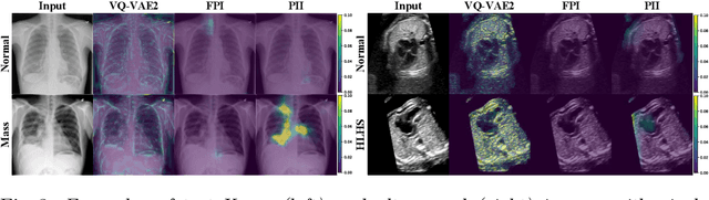Figure 4 for Detecting Outliers with Poisson Image Interpolation